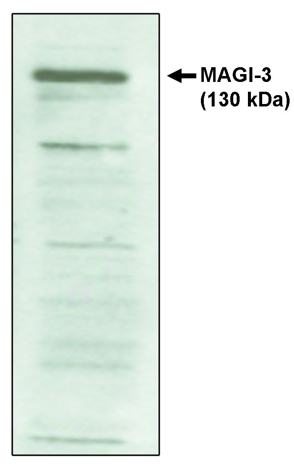 "Western blot analysis 
using MAGI-3, PDZ 4-5
antibody on cell lysates
transfected with
full-length human MAGI-3
protein."